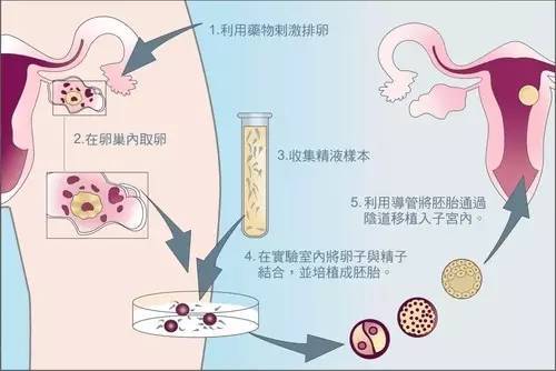 吉林hc试管医院